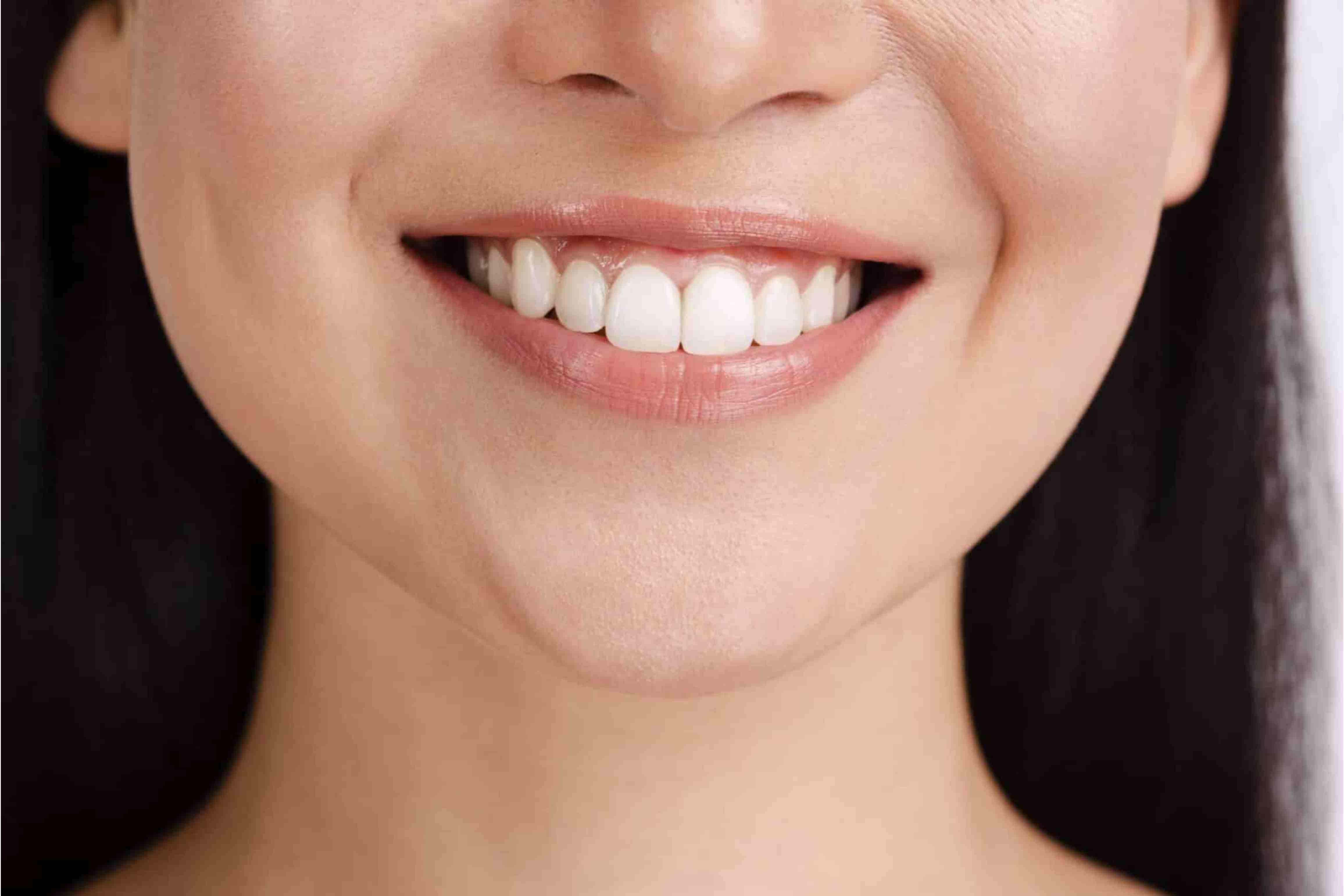 Smile Evaluation